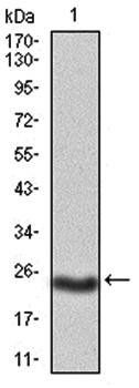 PKHD1 Antibody