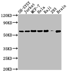 PKM antibody