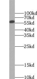PKM1-specific antibody