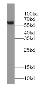 PKM2-specific antibody