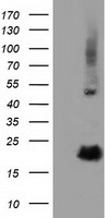 PKMYT1 Antibody