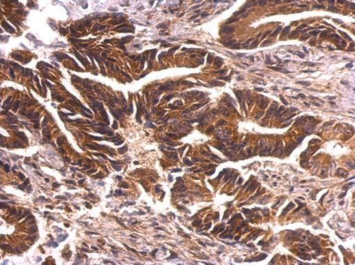 PKN2 Rabbit Polyclonal Antibody