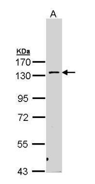 PKN2 Rabbit Polyclonal Antibody