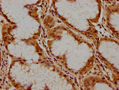 PKN3 Antibody