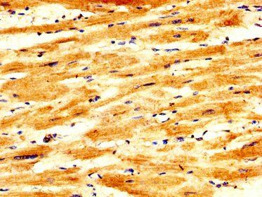 PKP2 Antibody