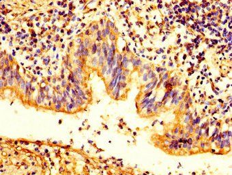 PKP2 Antibody