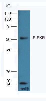 PKR (phospho-Thr451) antibody