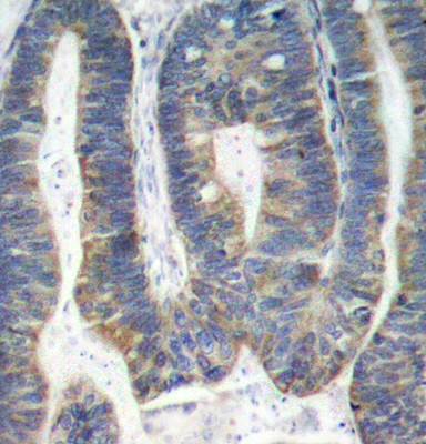 PKR (Ab-451) Antibody