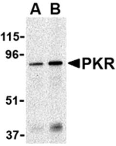 PKR Antibody