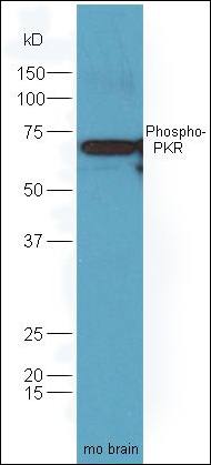PKR (phospho-Thr446) antibody