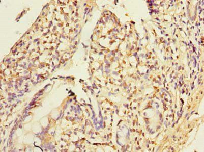PLA2G16 Antibody