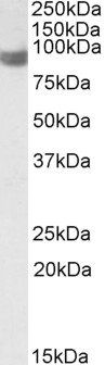Goat anti-PLA2G4A Antibody