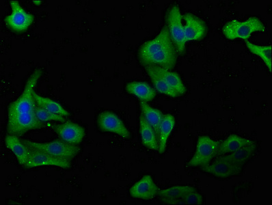 PLA2G4B Antibody