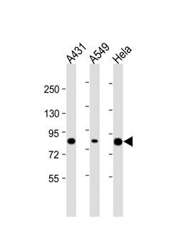 PLA2G4D antibody