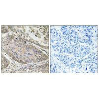 PLA2G4E Antibody