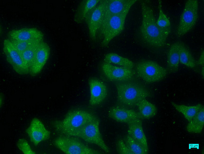PLA2G4E Antibody