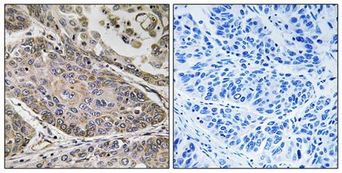 PLA2G4E Antibody