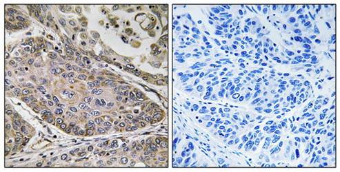 PLA2G4E antibody