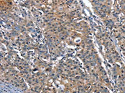 PLA2G6 Antibody