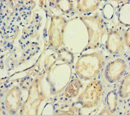 PLA2R1 Antibody
