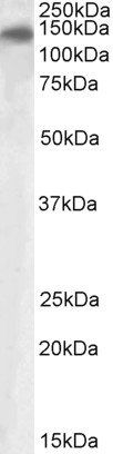 PLA2R1 antibody