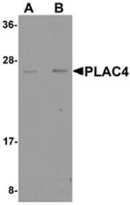 PLAC4 Antibody