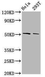 PLAGL2 Antibody