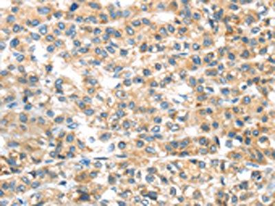 PLAGL2 Antibody
