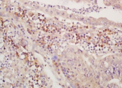 PLAGL2 Rabbit Polyclonal Antibody