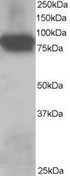 Goat anti-Plakoglobin / Gamma-catenin Antibody