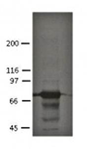 Plakophilin 1 Monoclonal Antibody [19F10]