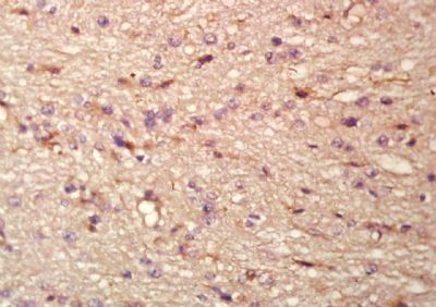 Plakophilin 1 Rabbit Polyclonal Antibody
