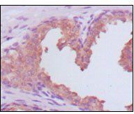 PSA (KLK3) Antibody