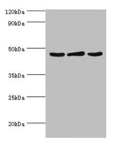 Plasminogen activator inhibitor 2 type A antibody