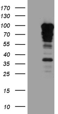 Plasminogen (PLG) antibody