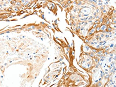 PLAT Antibody