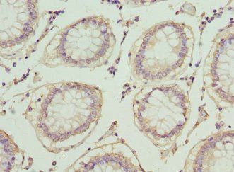 PLA2G7 Antibody
