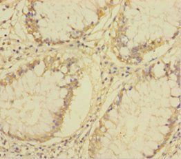 Platelet-activating factor acetylhydrolase antibody