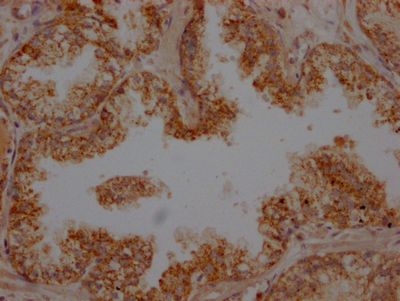PLAU Recombinant Monoclonal Antibody