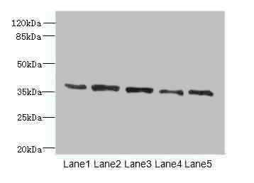 PLAUR antibody