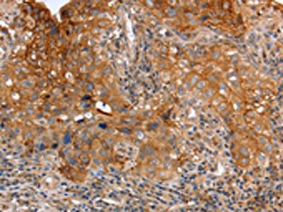 PLAUR Antibody