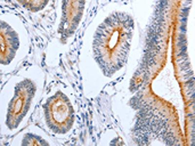 PLAUR Antibody