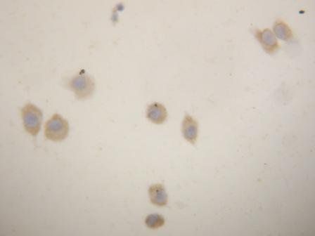 Anti-uPA Receptor/PLAUR Antibody