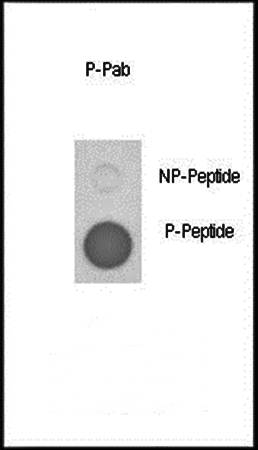 PLB (phospho-Thr17) antibody