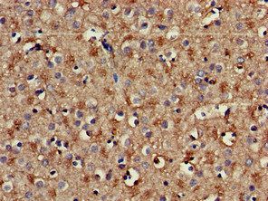 PLCB1 Antibody
