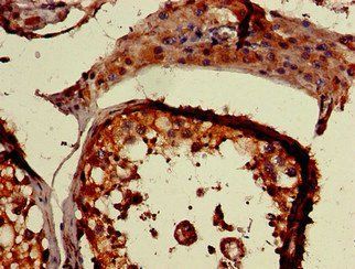 PLCD1 Antibody