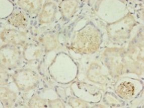 PLCD4 Antibody