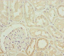 PLCD4 antibody