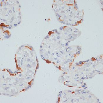 PLCG1 (Phospho-S1248) antibody
