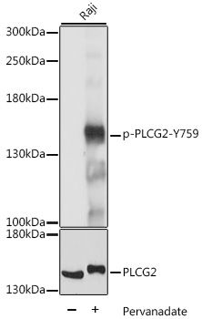 PLCG2 (Phospho-Y759) antibody